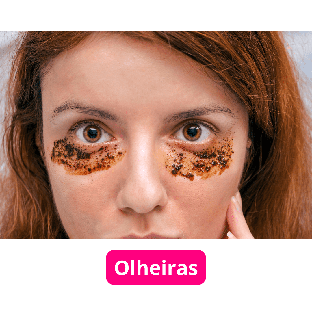 Olheiras: Dicas para Iluminar Seus Olhos!